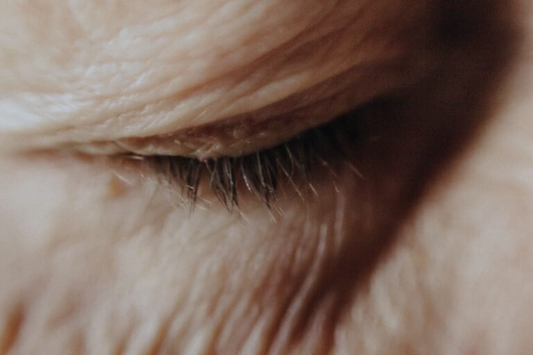collagen loss fine lines wrinkles around eyes close up